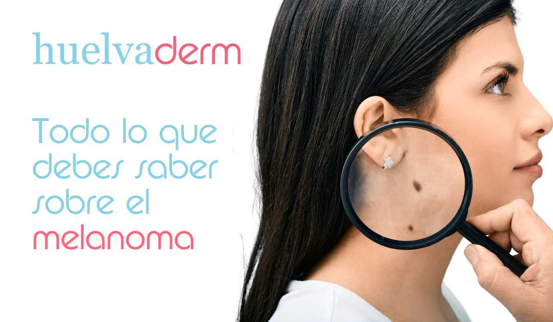 Día Europeo del Cáncer de Piel: todo lo que debes saber sobre el melanoma
