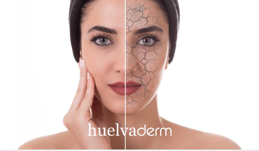¿Otoño y piel seca?, te cuento cómo la puedes prevenir